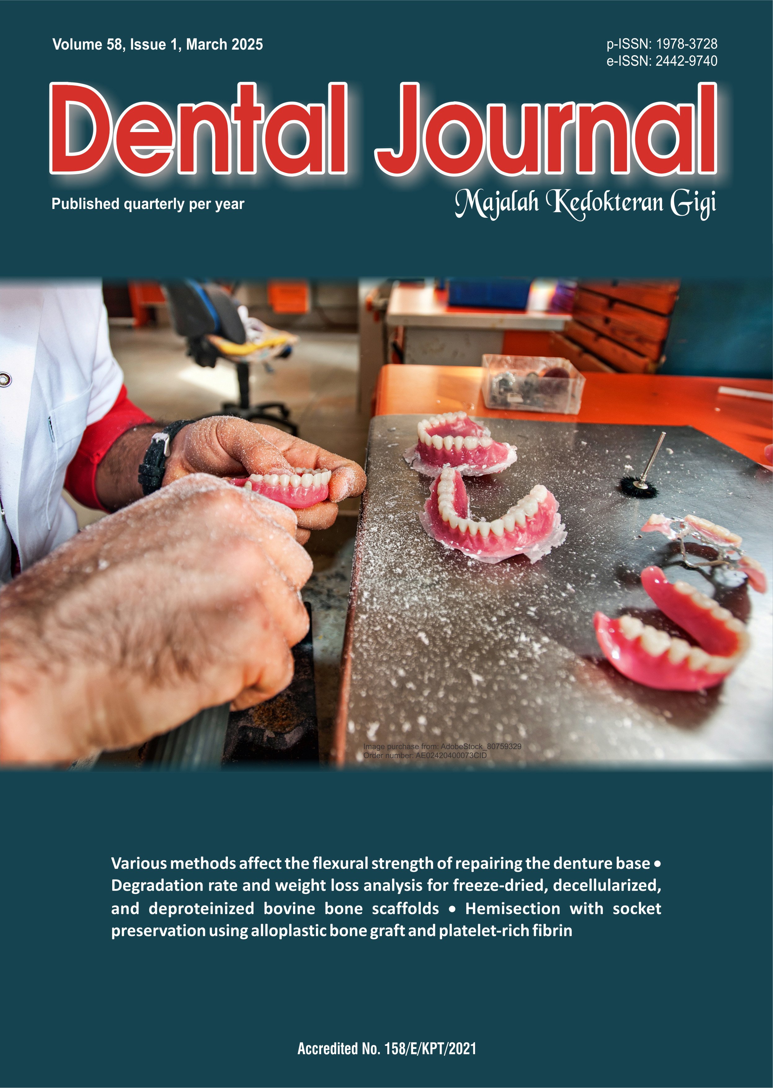 Dental Journal (Majalah Kedokteran Gigi)